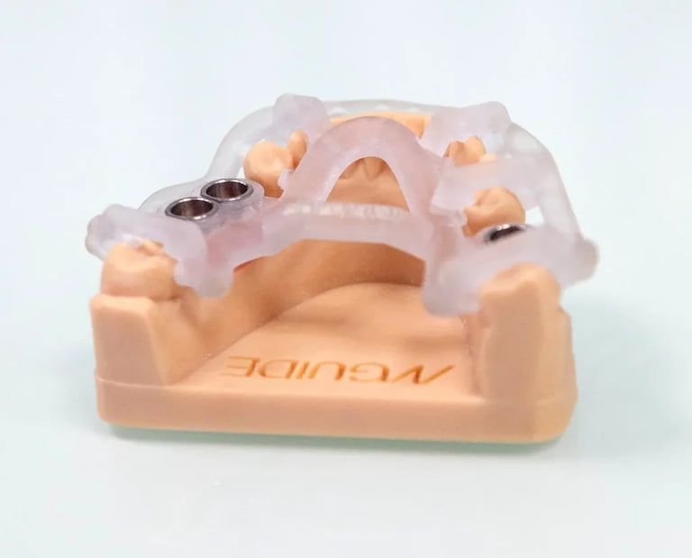 Precio de implantes dentales en sevilla