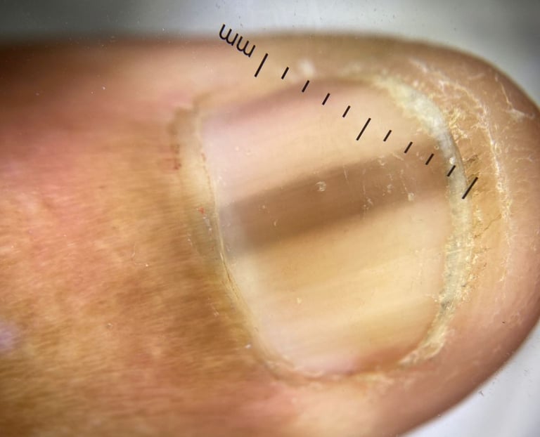 Melanoníquia, Salvador/Bahia