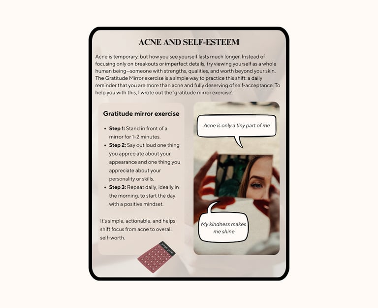 Digital guide titled 'The Ultimate Acne Guide: A holistic approach to healing and accepting acne'.