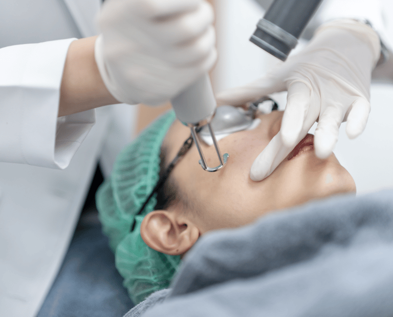 person getting pico laser facial treatment