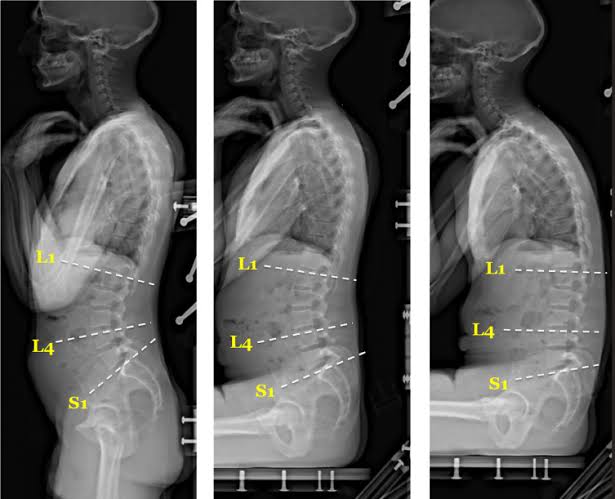 Vetrivel Health center best chiropractic and varamam theraphy 