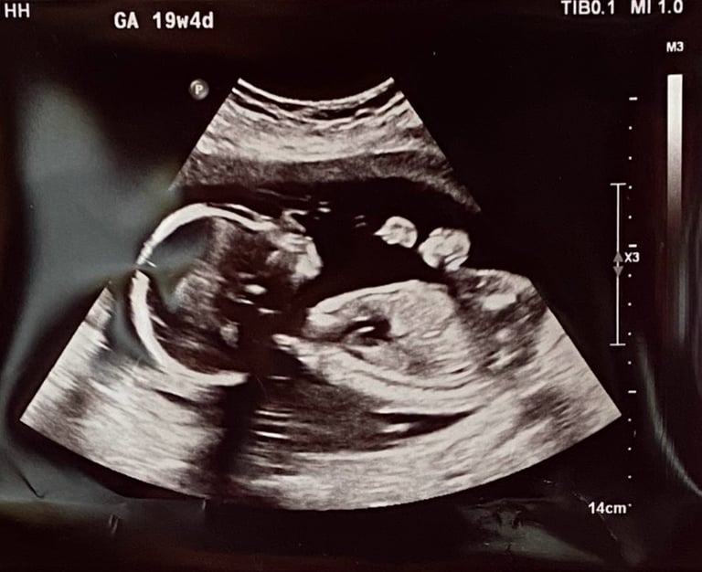 a baby's four month ultrasound scan