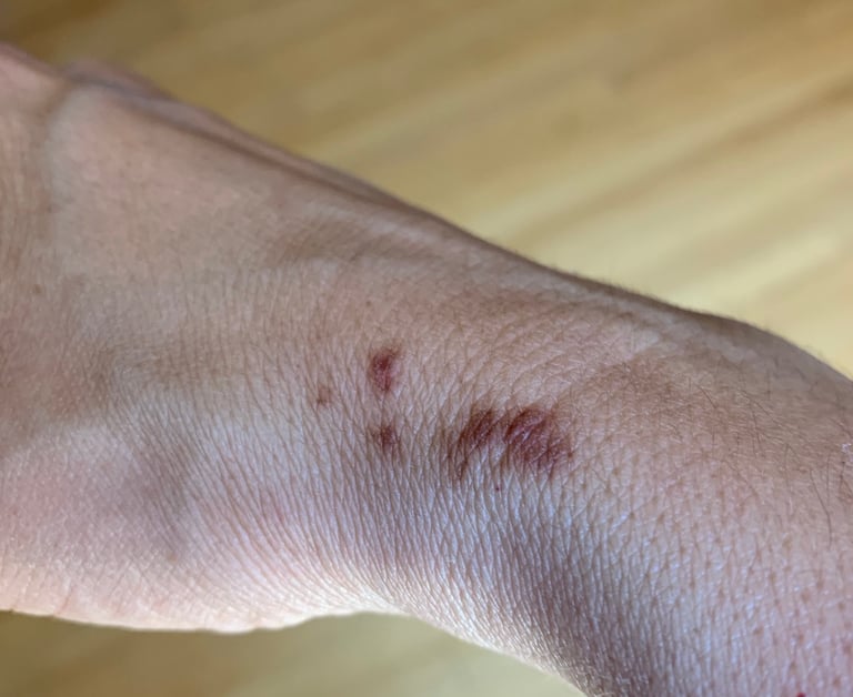 dark spots on a person's wrist, an inflammation response