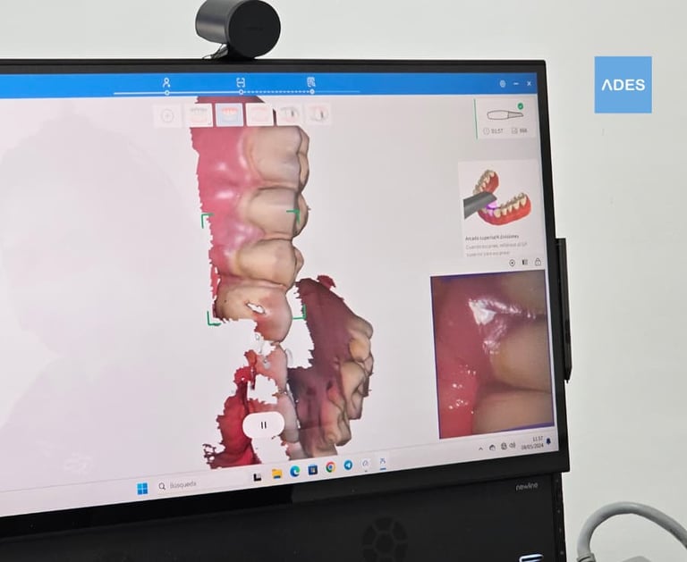 escáner intraoral 3D