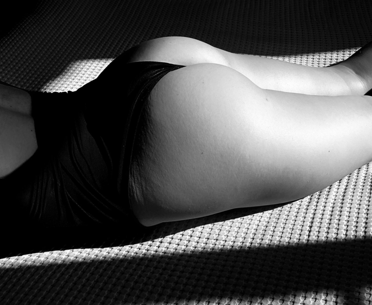 Brezilya popo estetiği uygulaması sonrası popo kontur