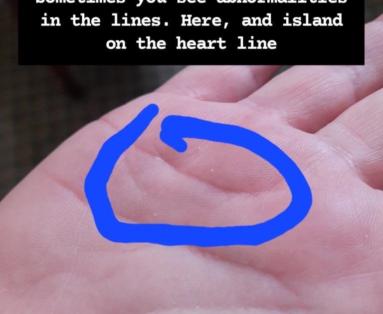 palmistry a heartline with a drooping island