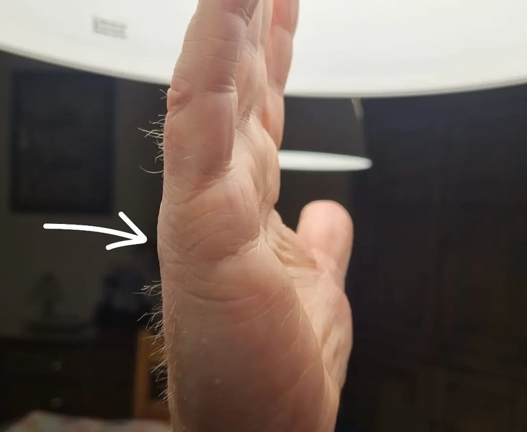 the marriage lines shown on the hand