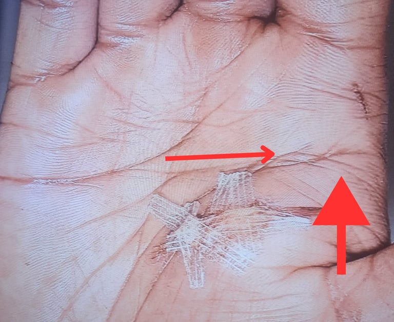 Palmist and author rob hamilton decoding murderers hand