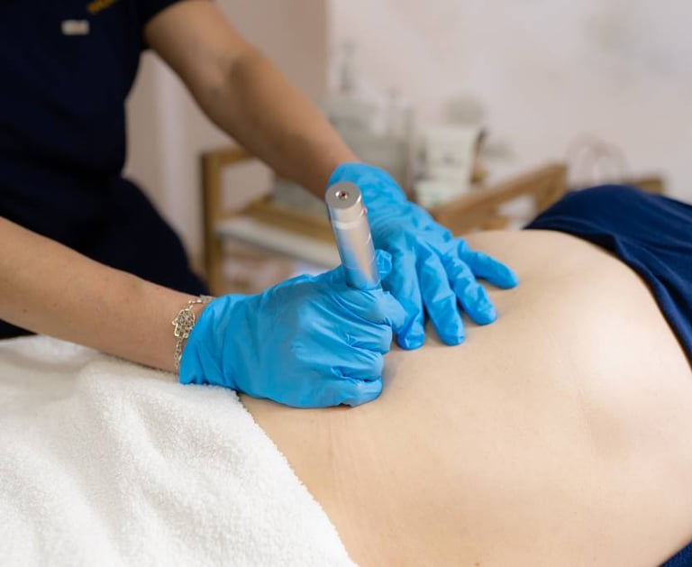 dermapen