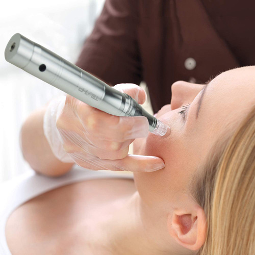 dermapen microneedling