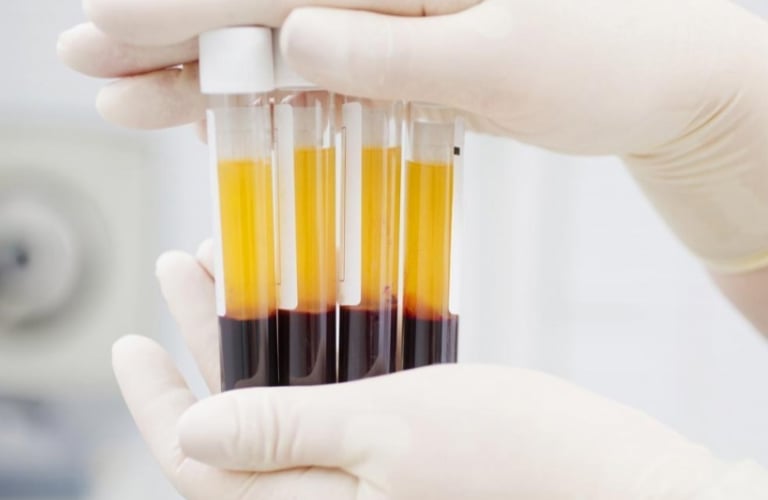 PRP Plasma Rico en Plaquetas
