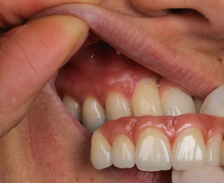 a person trying on dental implant models