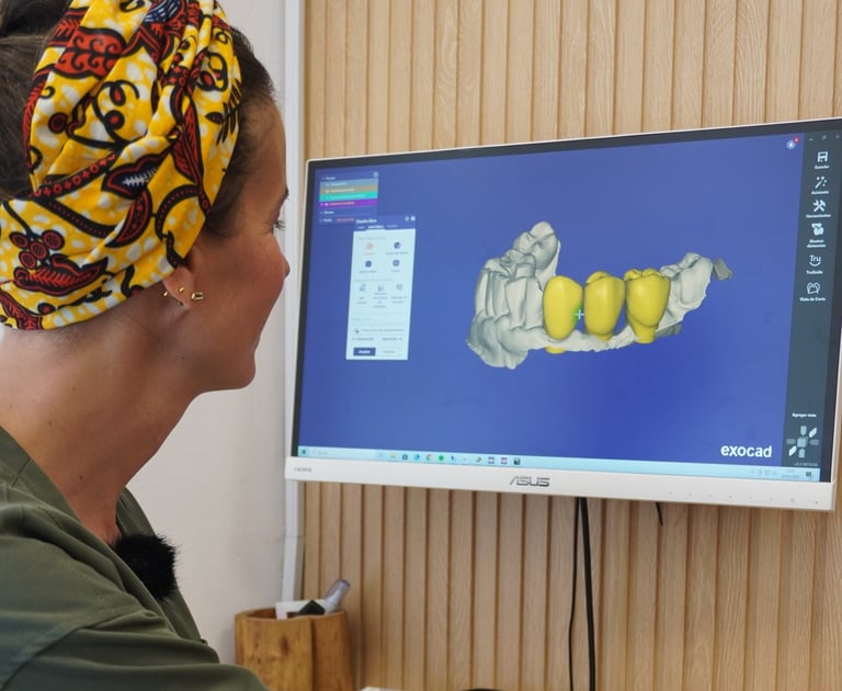 Tipos de coronas dentales que trabajamos en Sevilla