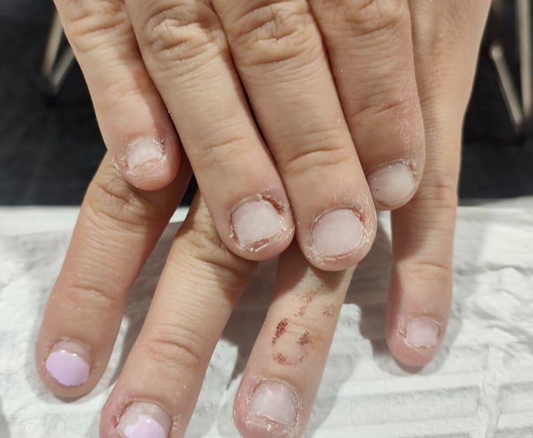 Onicofagia, Manicura en Barcelona, salón de uñas Barcelona, mejor salón de uñas en Barcelona, uñas acrílicas, nail art, gel x