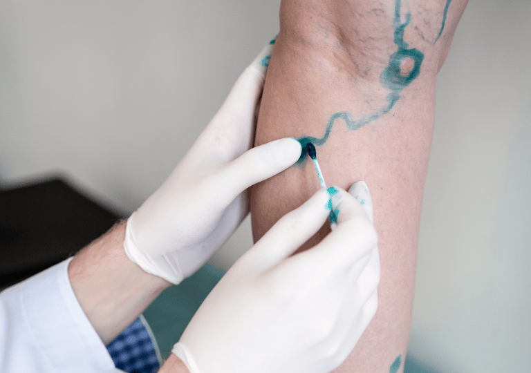 Vascular Surgery at Bone Care One Day Surgery Center in Abu Dhabi