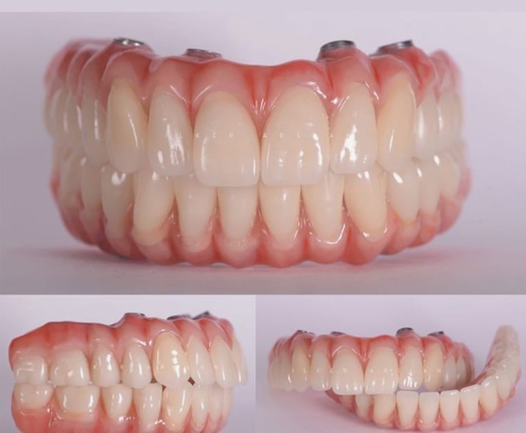 a dental implant model