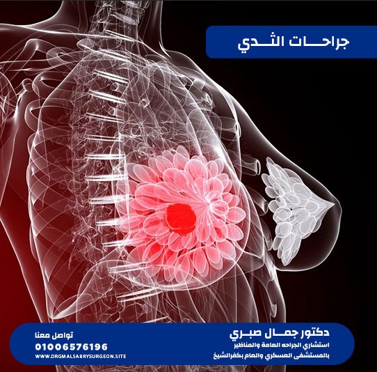 جراحات الثدي كفرالشيخ