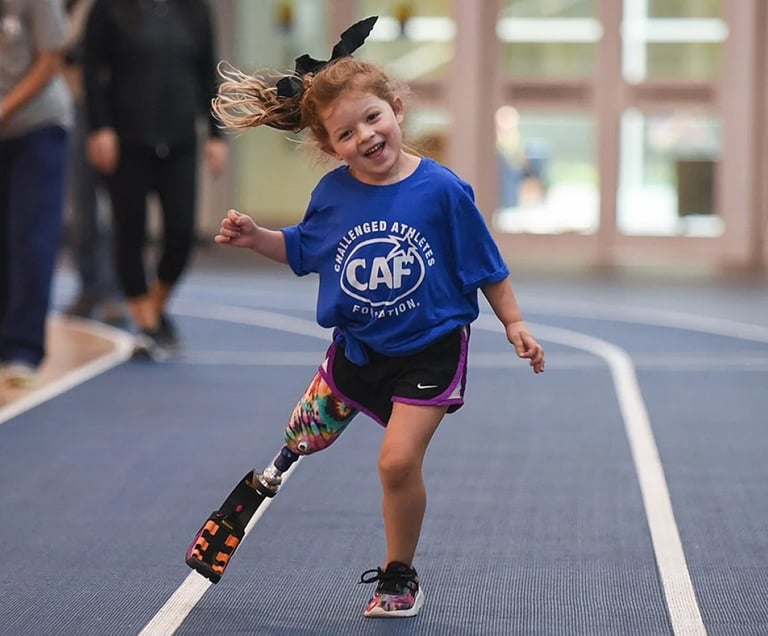 Helping children prosthetic limbs