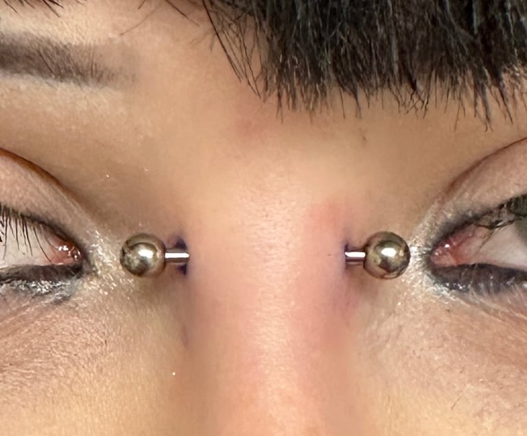 A close-up of a symmetrical bridge piercing with titanium barbells. The jewellery sits evenly across