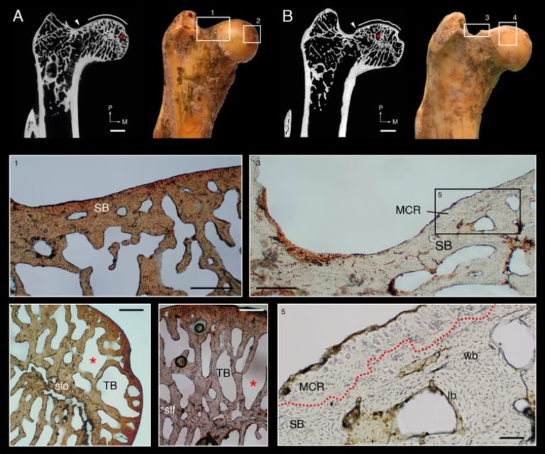 Osteoartritis en Prolagus sardus, un lagomorfo extinto que habitó Cerdeña en el Pleistoceno tardío.
