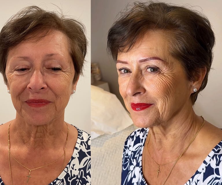 Dermopigmentation de correction chez DermoRepair Clinic Charleville-Mézières