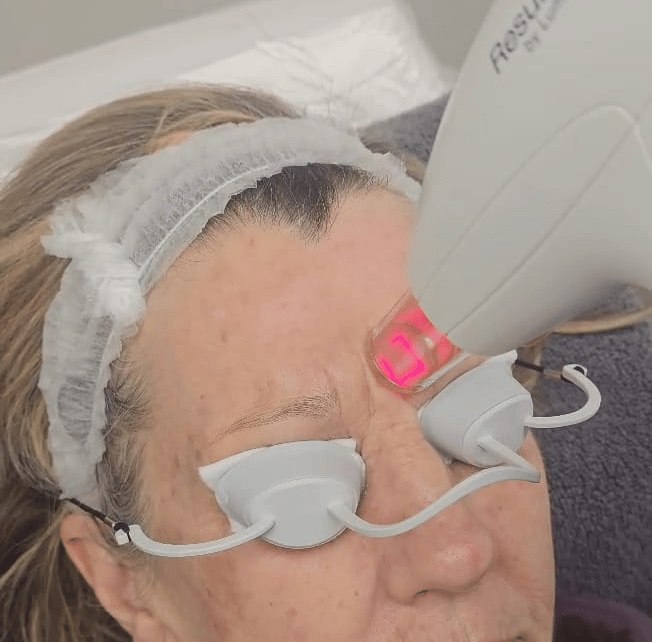 ResurFX treatment for a woman at Ariana Esthetic Edmonton