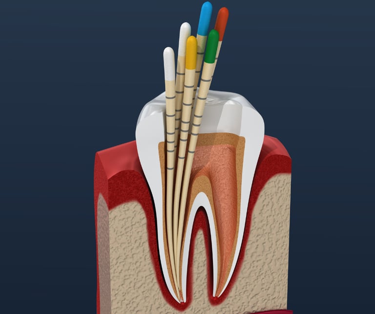 Endodonzia