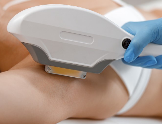 IPL SHR Hair removal singapore