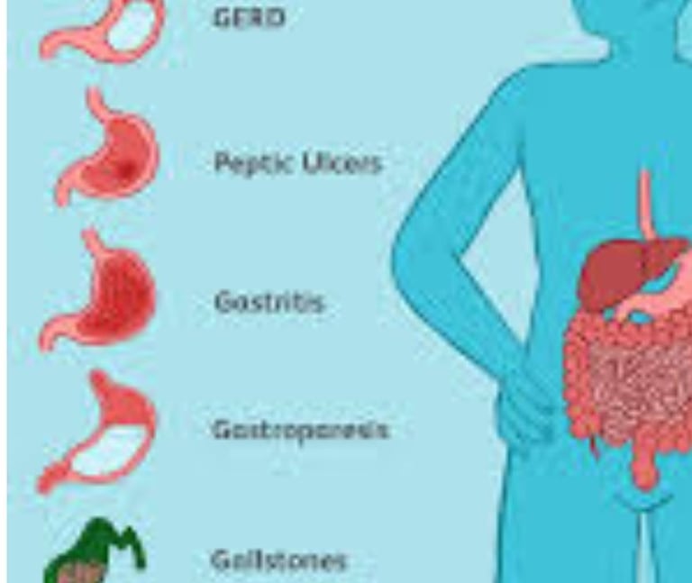 Emesis and Upper Digestive Tract Blockages