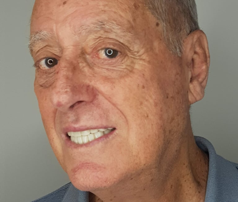 Sorriso rejuvenescido de paciente idoso tratado com resinas estéticas , Tatuape dentista