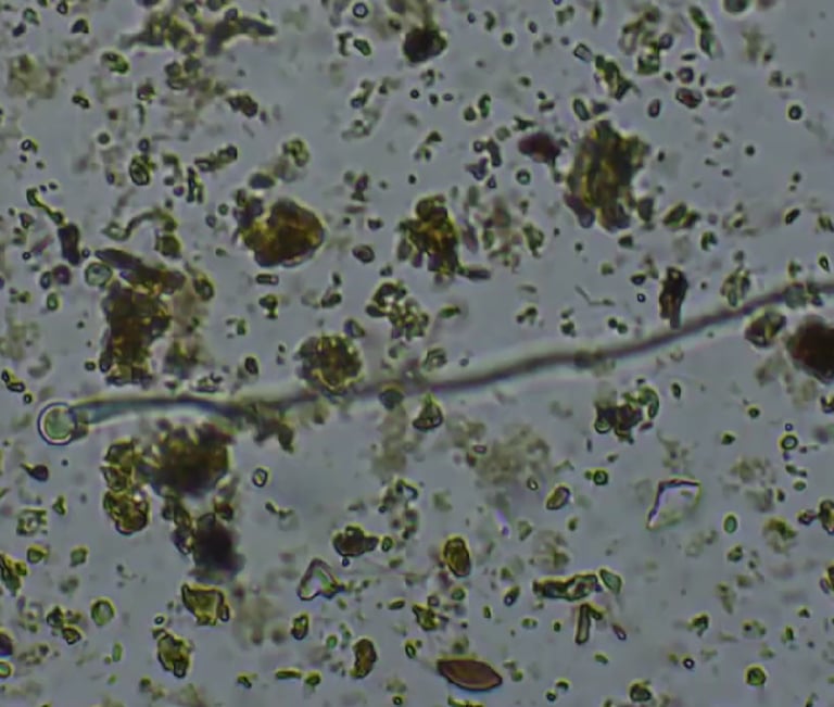 Soil Microbes under the microscope