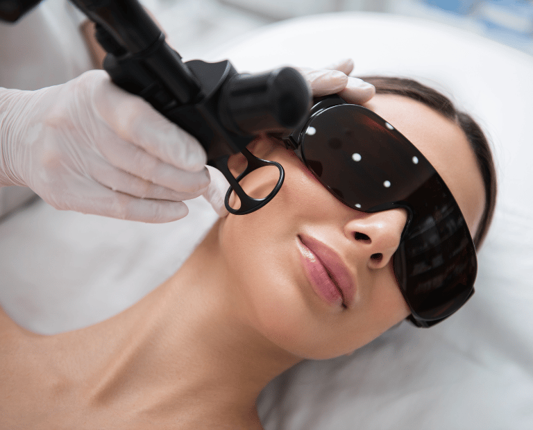 fractional CO2 laser on woman's cheek