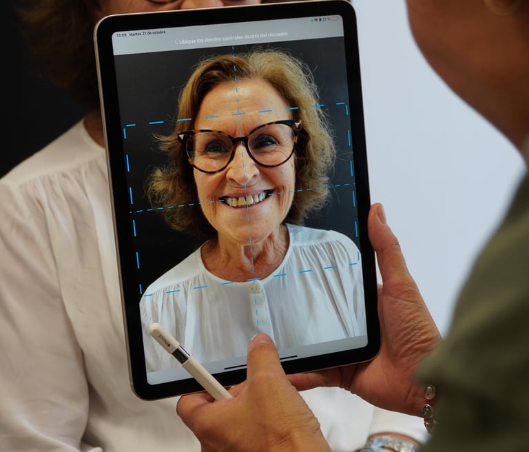 Diseño de sonrisa con Carillas en Sevilla