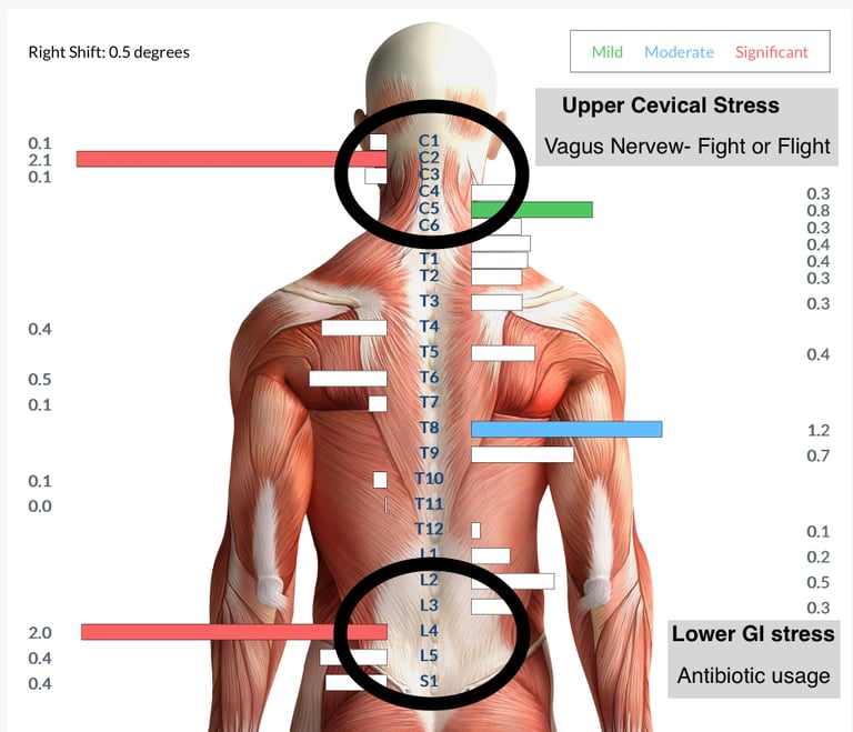 Neurological INSiGHT scans measuring nervous system stress linked to chronic ear infections in child