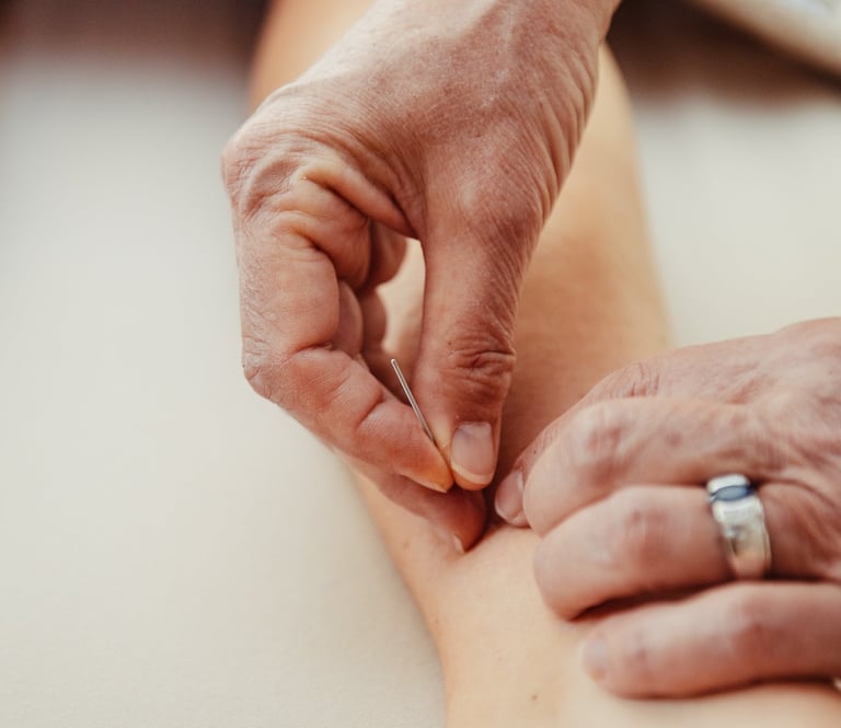 Acupuncture
