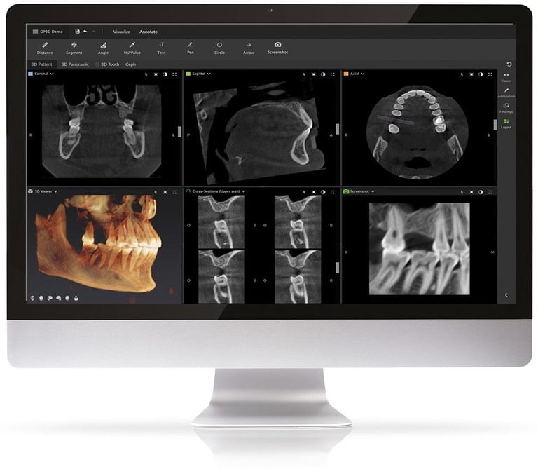 Desktop monitor displaying 3D dental imaging software with CBCT scans and orthodontic X-rays.