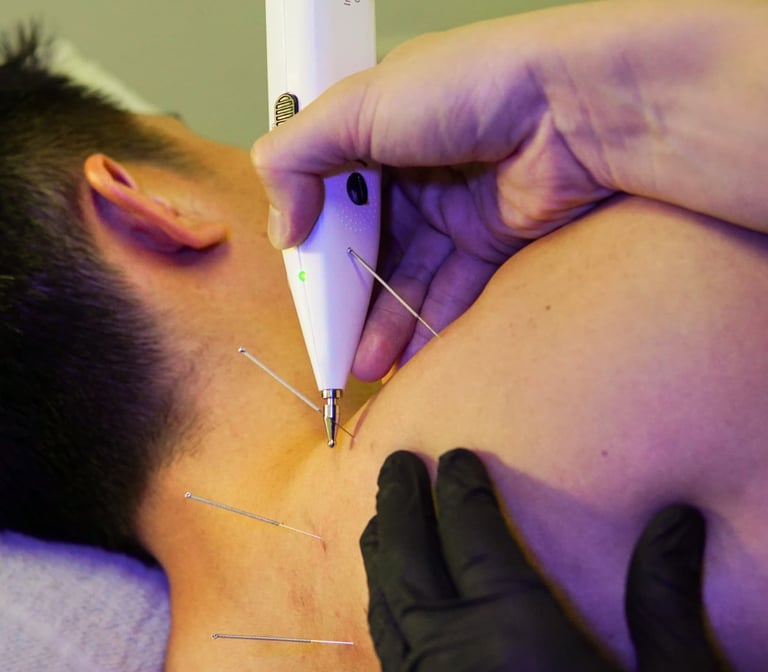 Electrical Dry Needling (EDN) useful for chronic muscular conditions
