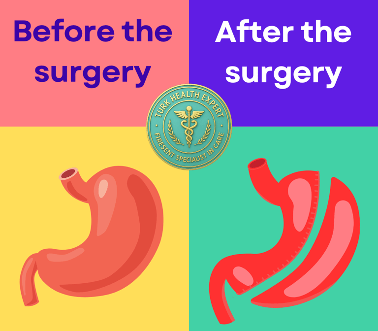 before and after a gastric sleeve