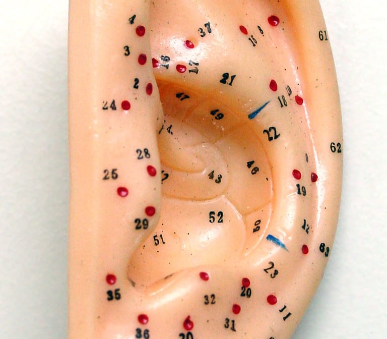 Auriculoterapia