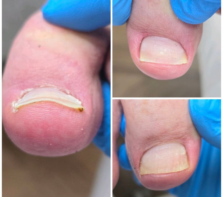 iauges nagas gydymo pabaiga 2024-02-24