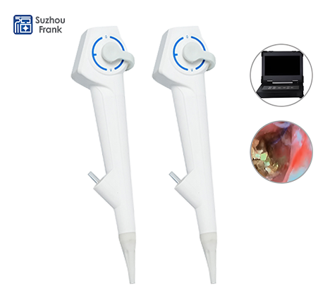 Disposable Choledochoscope Single-Use Sterile Endoscope for Bile Duct Exploration and Stone Removal