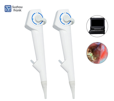 Disposable Choledochoscope Single-Use Sterile Endoscope for Bile Duct Exploration and Stone Removal