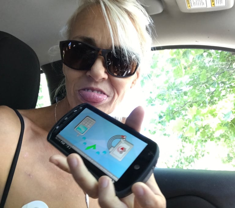 Heart Monitor in Burney California