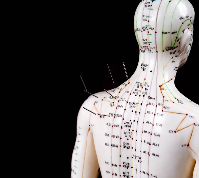 aiguilles acupuncture, médecine traditionnelle chinoise