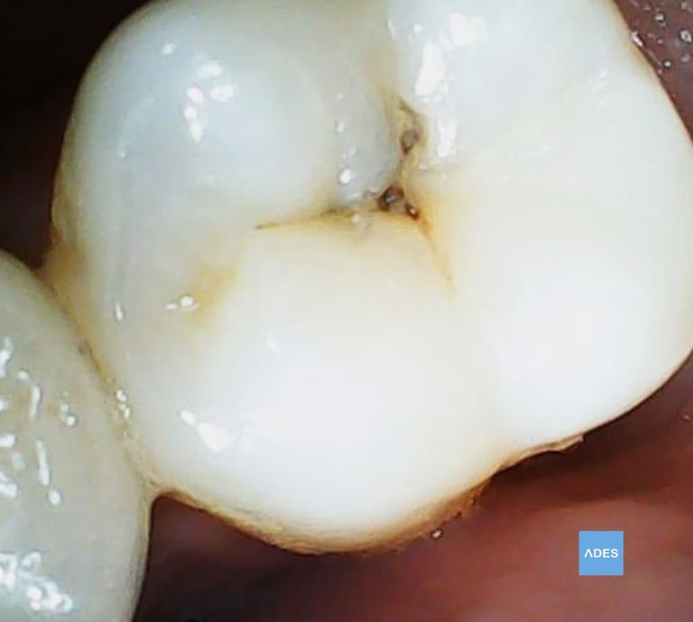 empaste dental