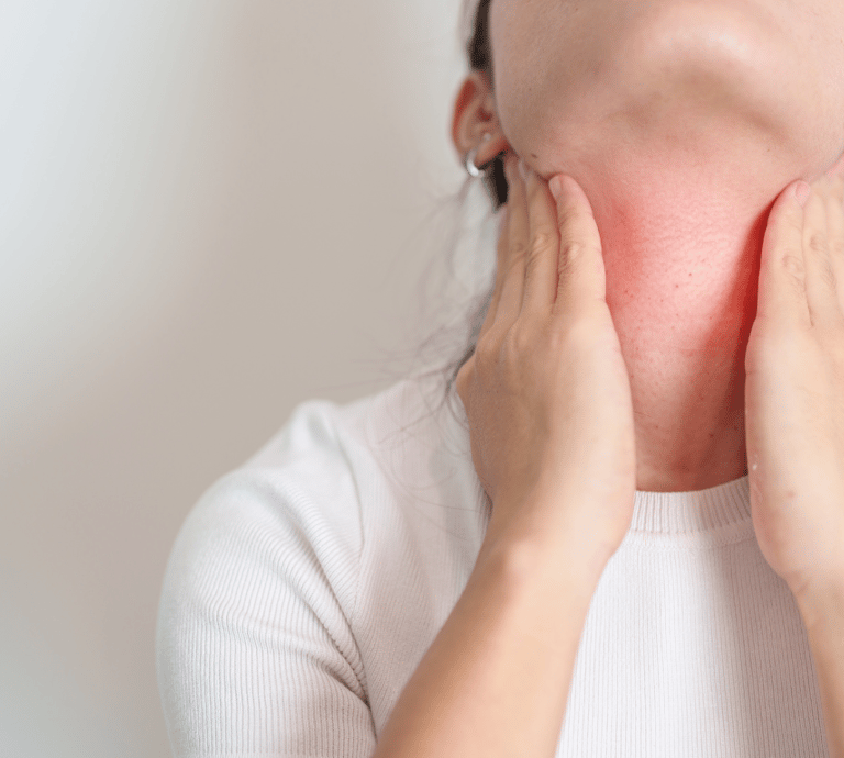 Basal Cell Carcinoma