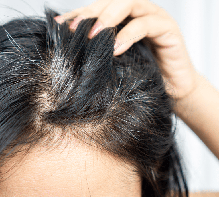 Gray Hair