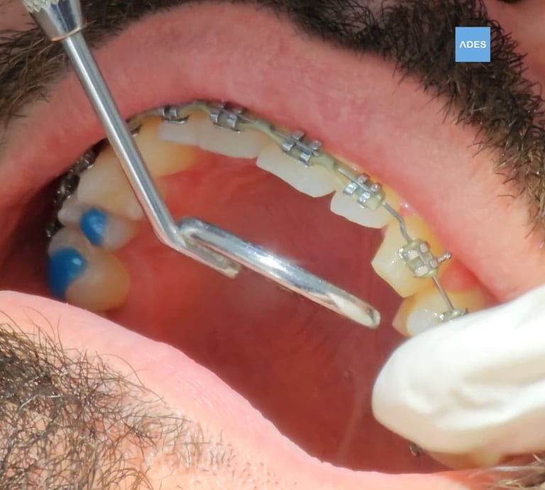 Tratamiento dental para adultos en Badajoz