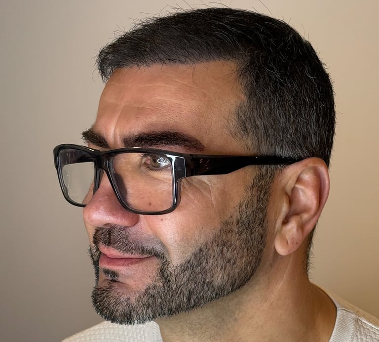 Dermopigmentation capillaire SMP sedan et charlevilles 08 pour calvitie et alopécie 