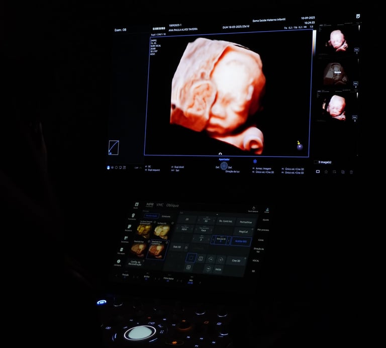 Sala de ultrassom premium com aparelho Samsung Hera Z20 na clínica Eema Indaiatuba.